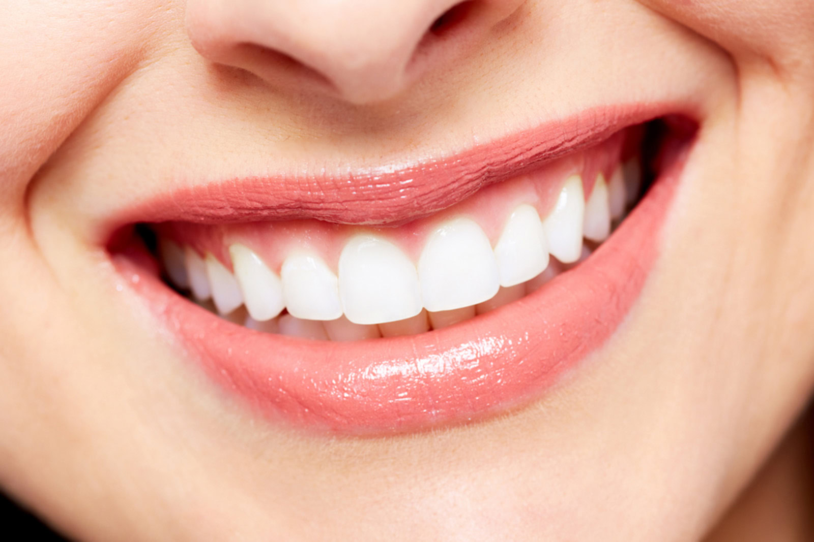 A smiling set of teeth