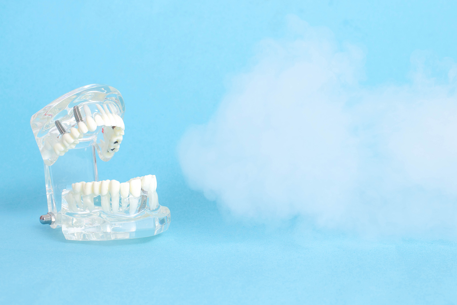 Ozone therapy model
